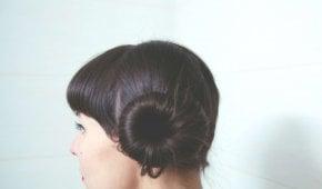 Hair Transplantation Centers in Turkey